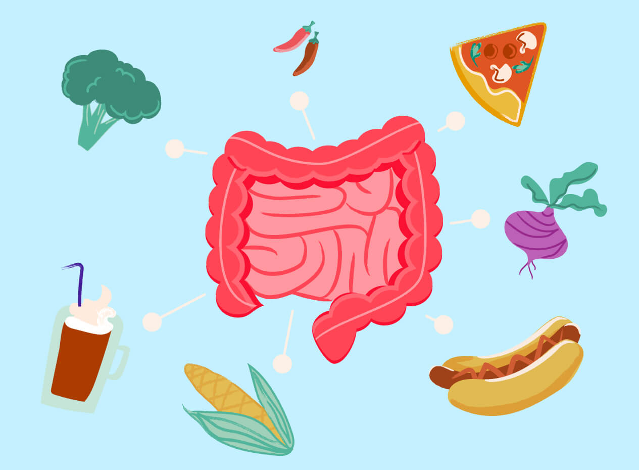 L'alimentation et le syndrome du côlon irritable