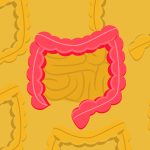 La maladie de Crohn, quoi manger et quoi ne pas manger?